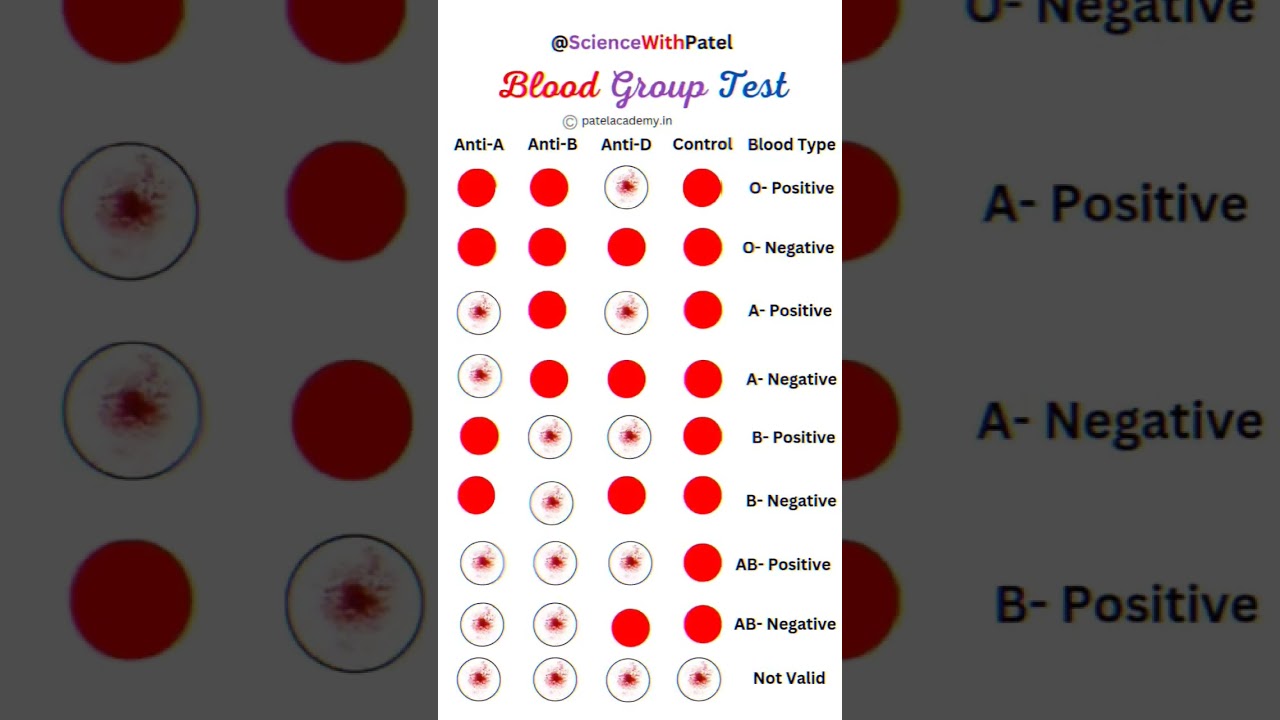 Blood group Test 💉