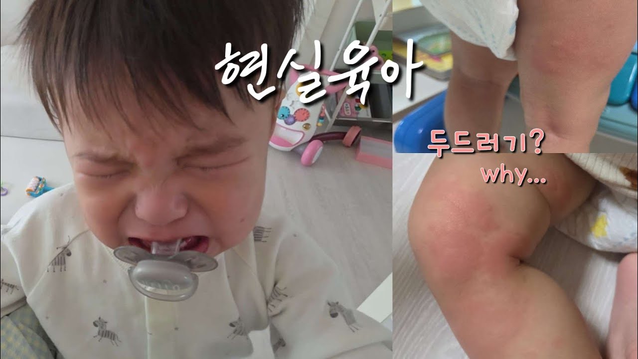 VLOG | 돌잔치 답례품 준비 | 원인 모를 두드러기? | 새벽마다 깨는 11개월 | 하루종일 짜증만 내는 일상😫