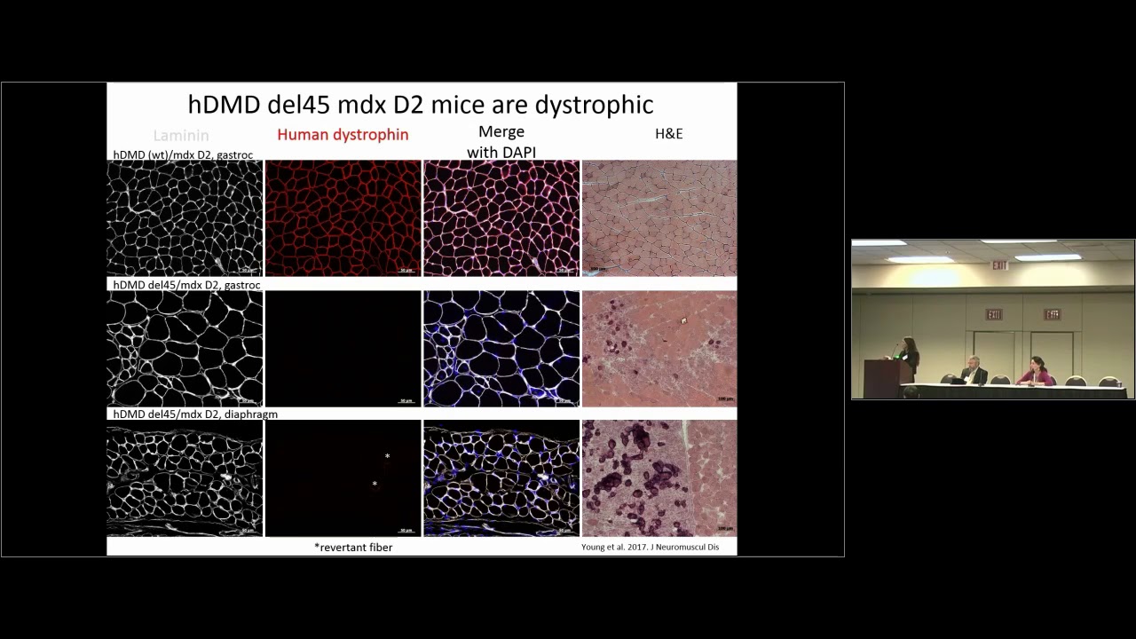 CRISPR-Cas9 Deletion Strategy that Targets the Majority of DMD Patients in hiPSC-derived Muscle