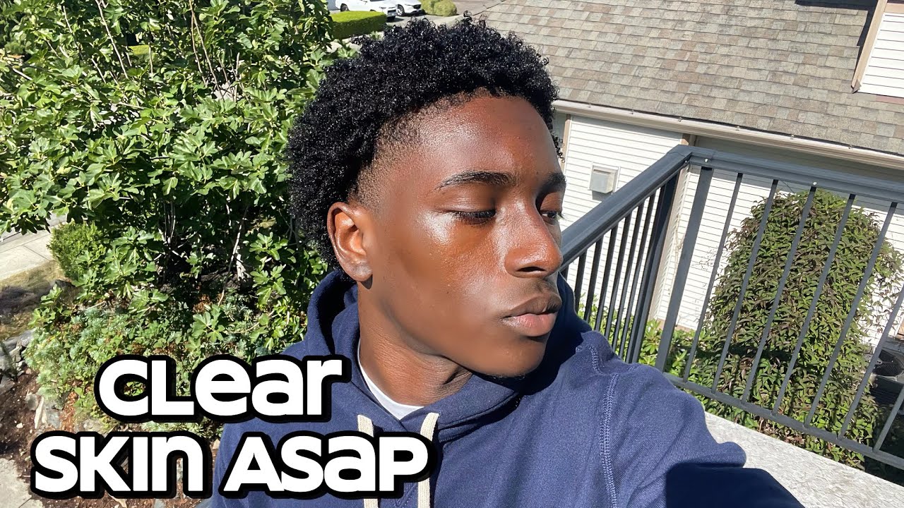 how to get clear skin for guys asap
