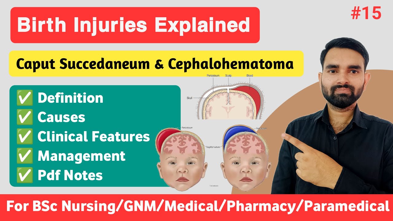 Birth Injuries of Newborn | Caput Succedaneum vs Cephalohematoma in Hindi