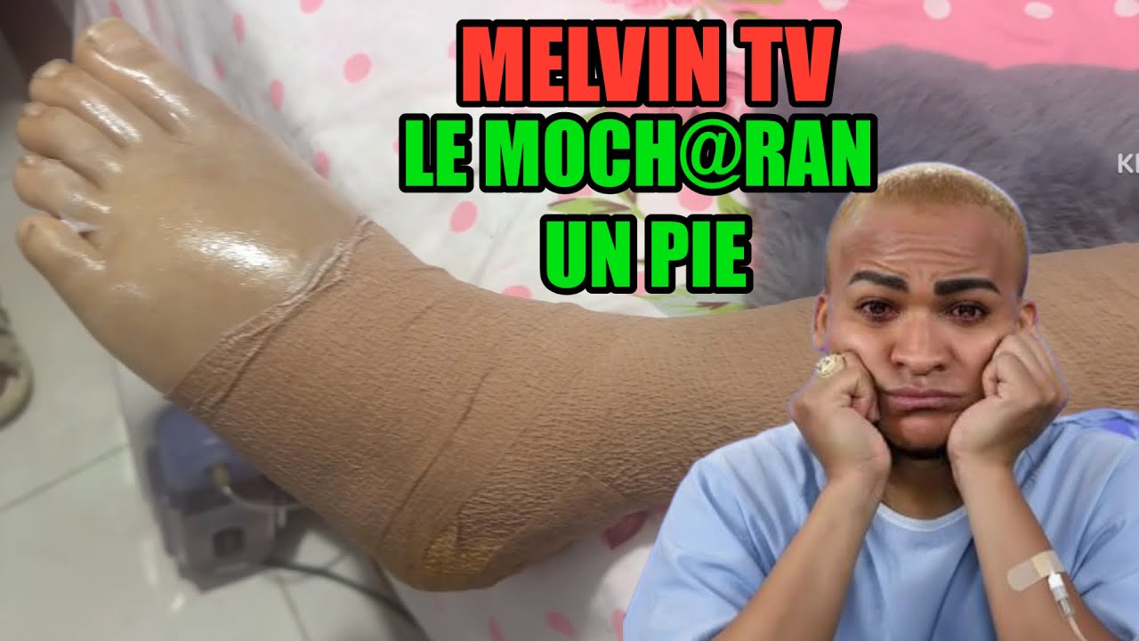 A MELVIN TV LE COT@RAN UN PIE, Wao 