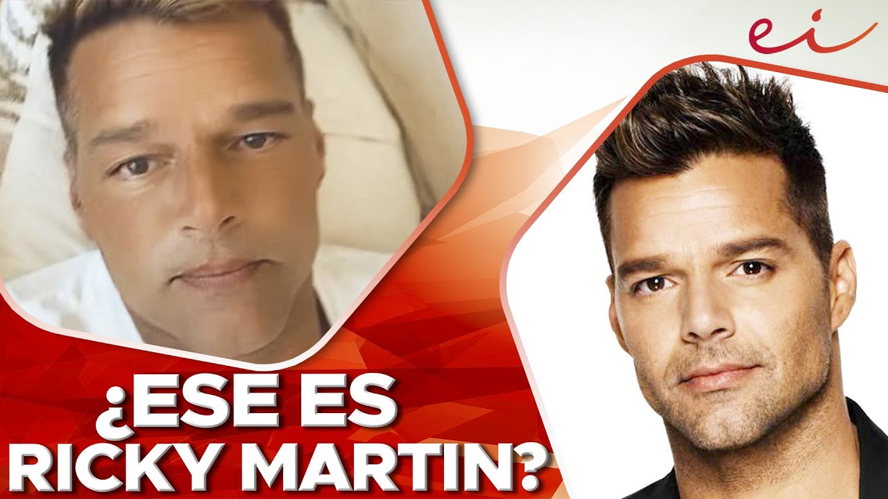 ¡IRRECONOCIBLE! Ricky Martin se ARREPIENTE de tratamiento Estético