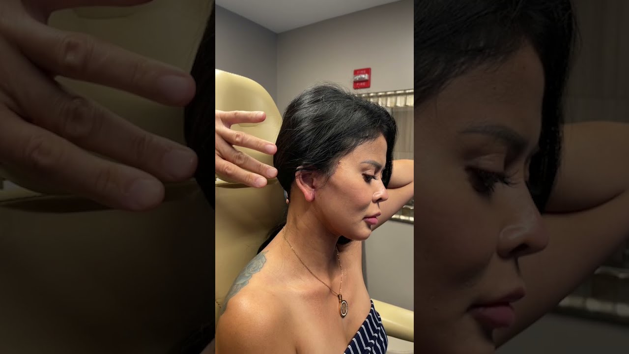 Custom Facelift Surgery Leaves Patient With The Most Natural-Looking Results