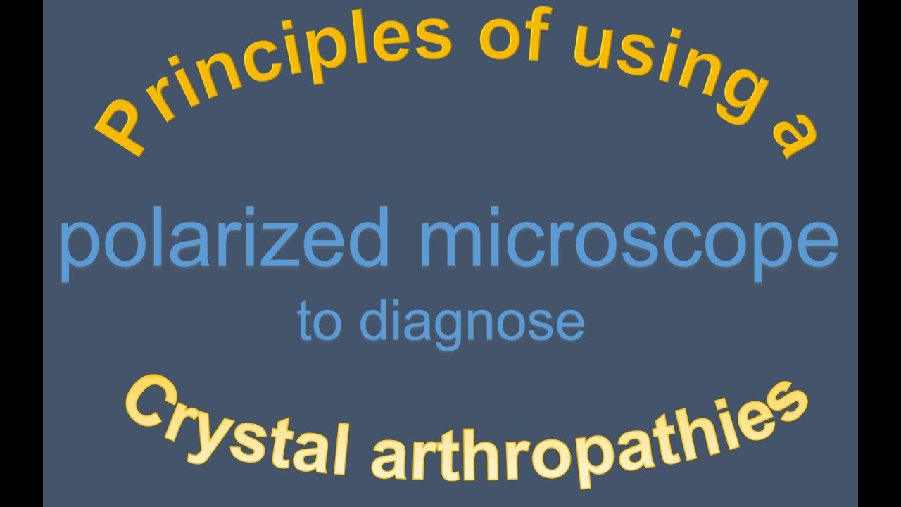 Principles of using a polarized microscope to diagnose Crystal arthropathies.