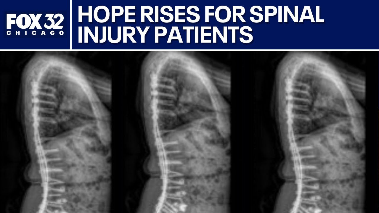 Breakthrough spinal injury drug shows promise