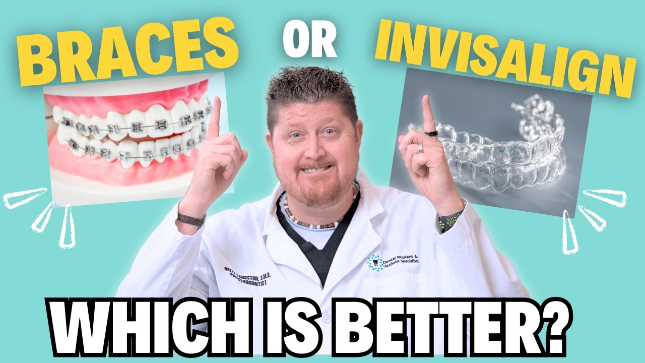 Invisalign or Braces: The Ultimate Guide to Choosing the Best for You