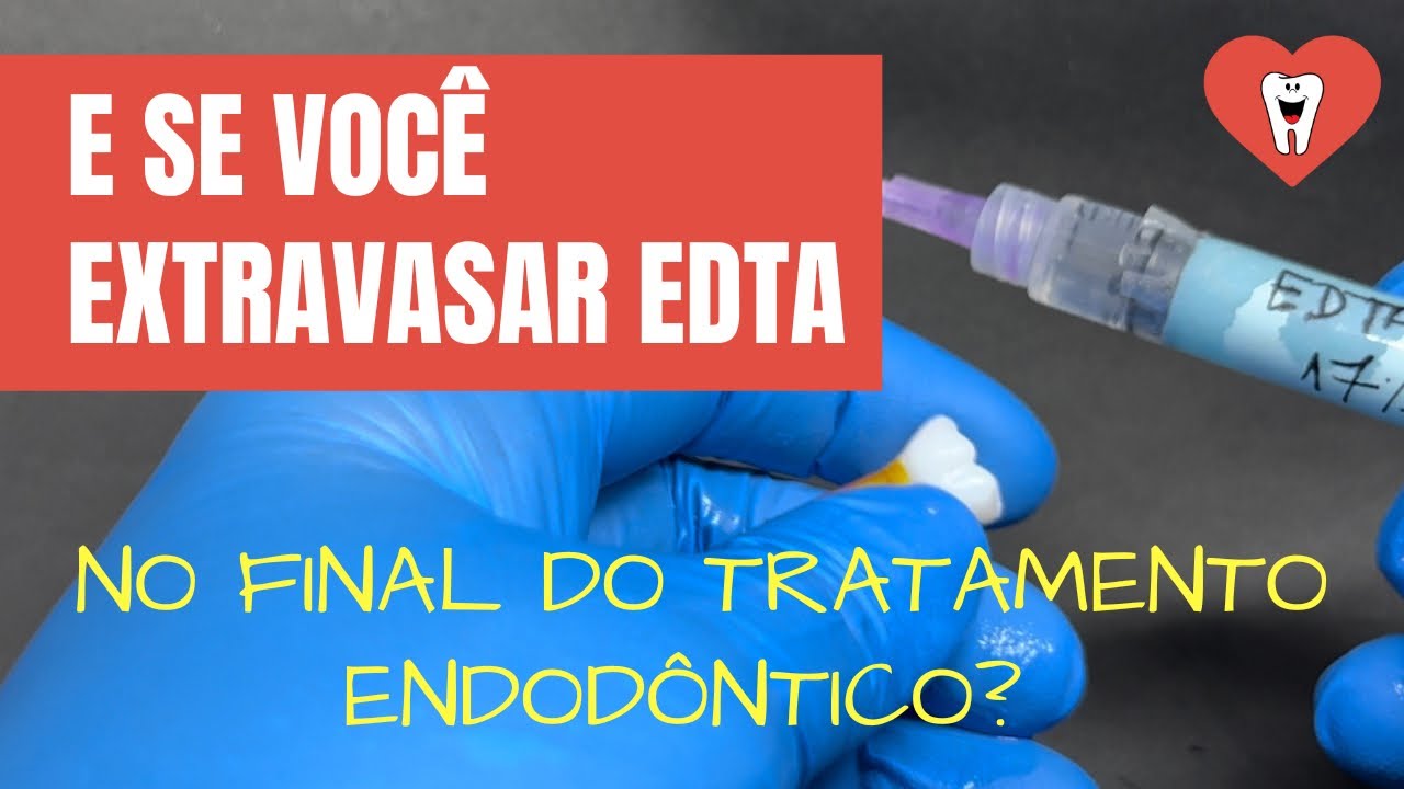 E SE VOCÊ EXTRAVASAR EDTA LOGO ANTES DE OBTURAR OS CANAIS?