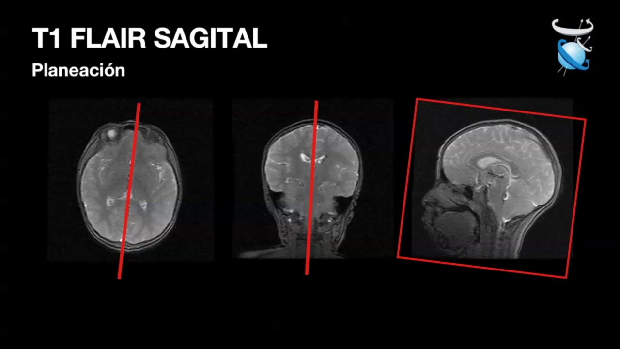 RM Cerebral Parte 3   Planeación