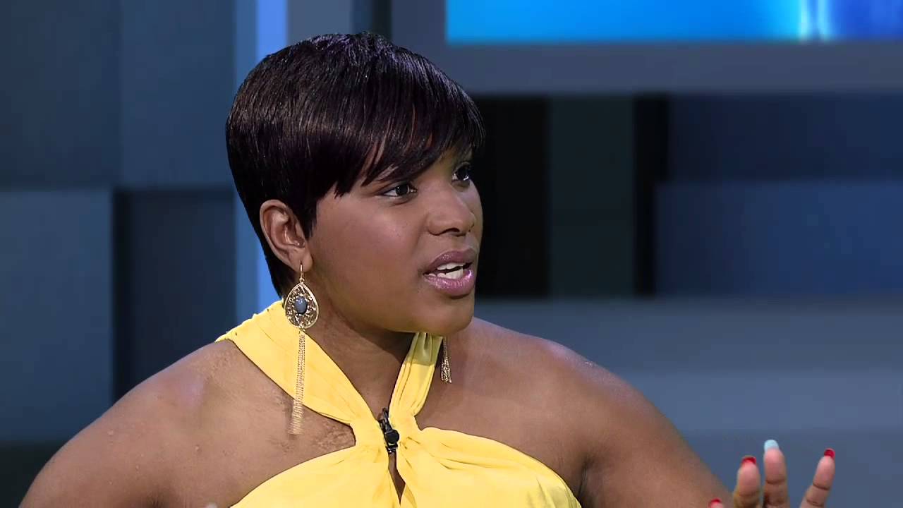 Mpho Tshabalala - Stroke Survivor