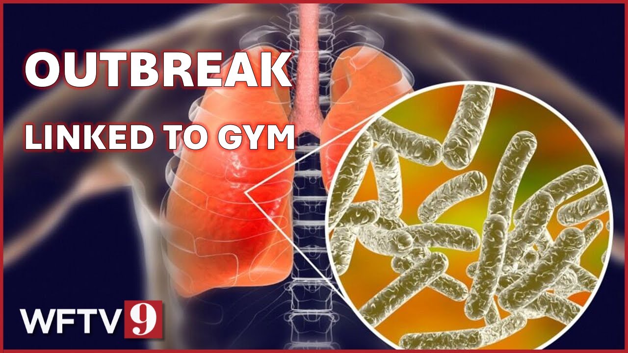 What to know about the gym-linked disease outbreak in Florida