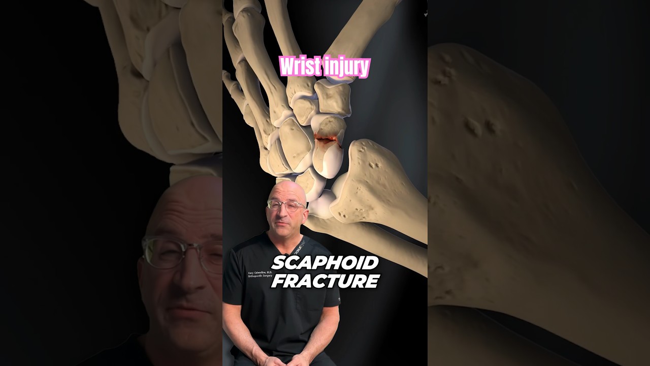 Frequently Misdiagnosed Reason Your Wrist Hurts #shorts