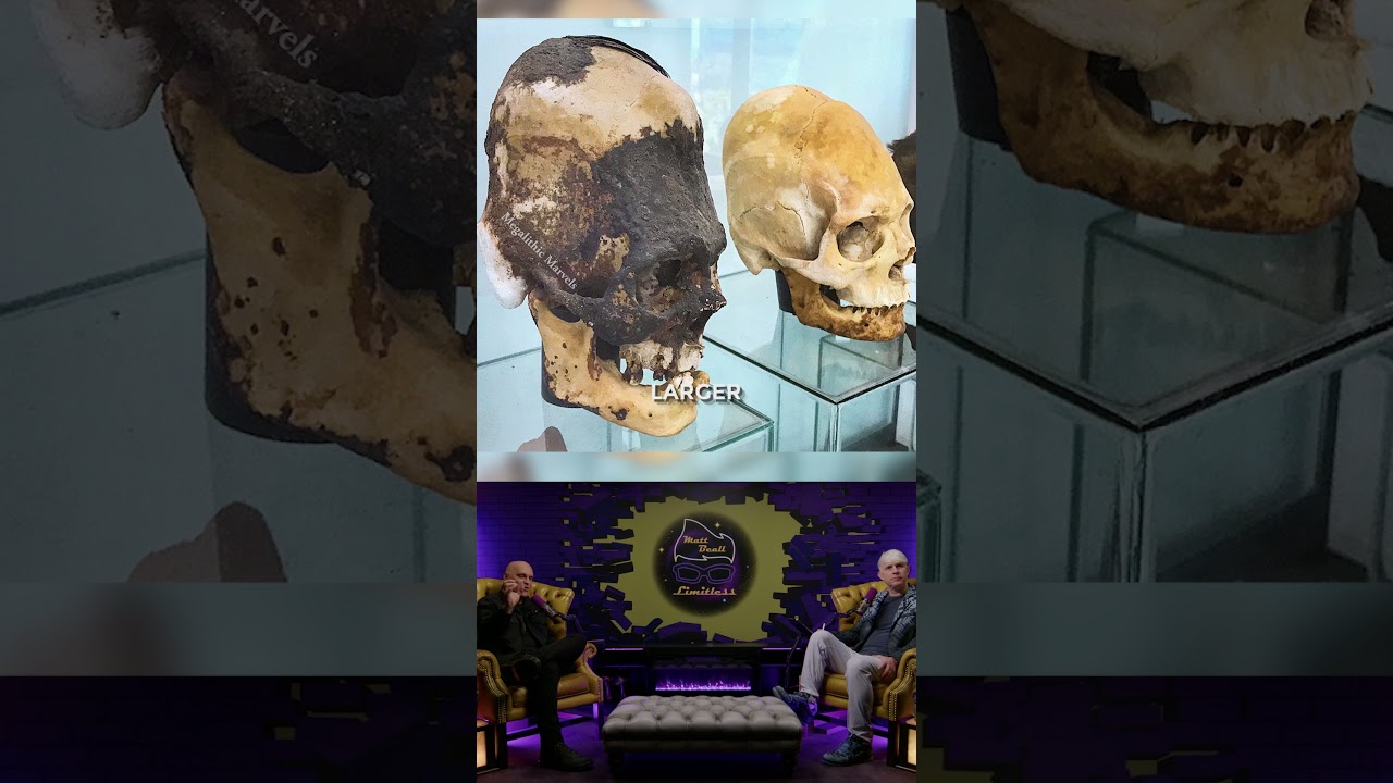 The Mystery of Peru&rsquo;s Elongated Skulls