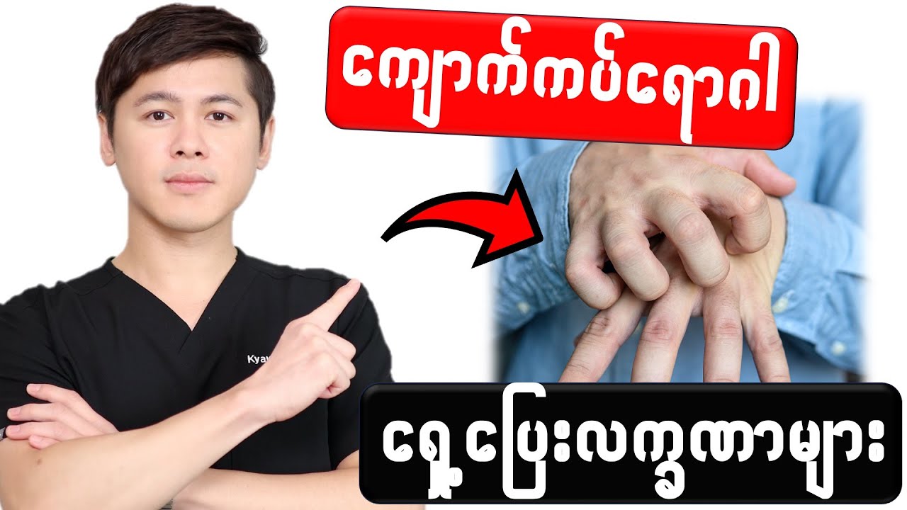 −− ကျောက်ကပ် ရှေ့ပြေးလက္ခဏာ (၉) မျိုး −−