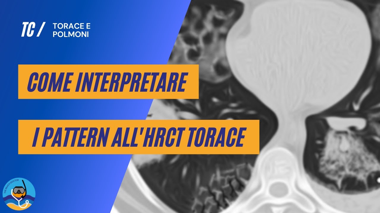 Come interpretare i pattern all'HRCT torace - parte 1