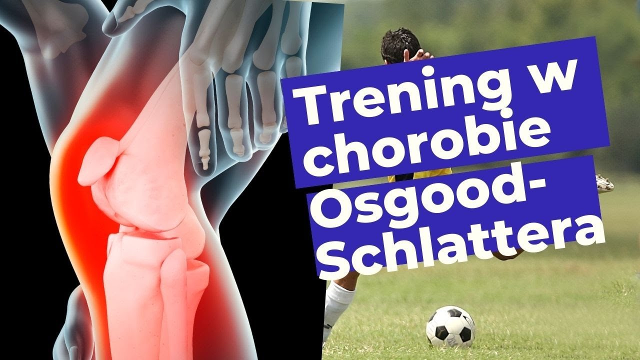 Jak Trenować W Martwicy Kości Piszczelowej (choroba Osgood-Schlattera)❓