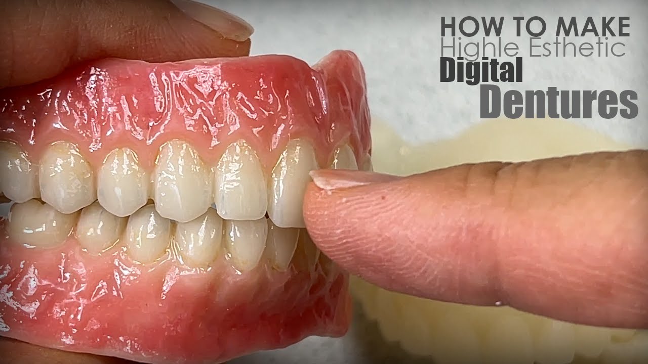 How to Make Highly-Esthetic Digital Dentures