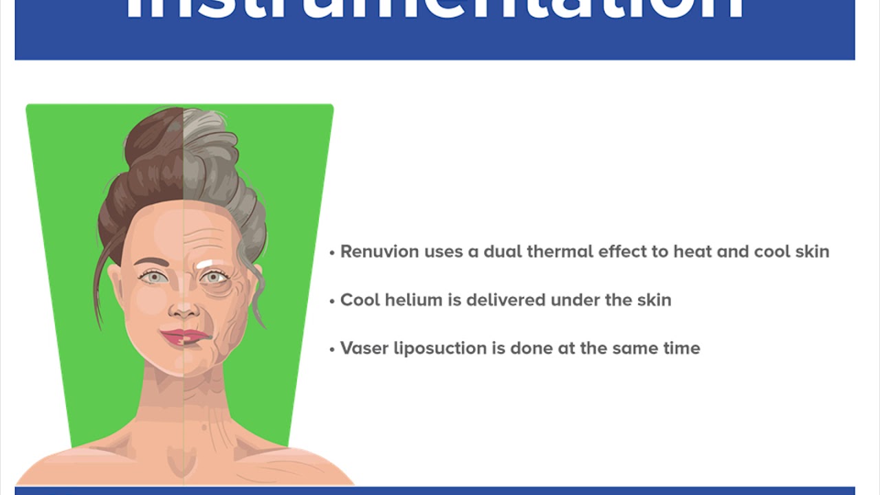 Renuvion Of Abdomen