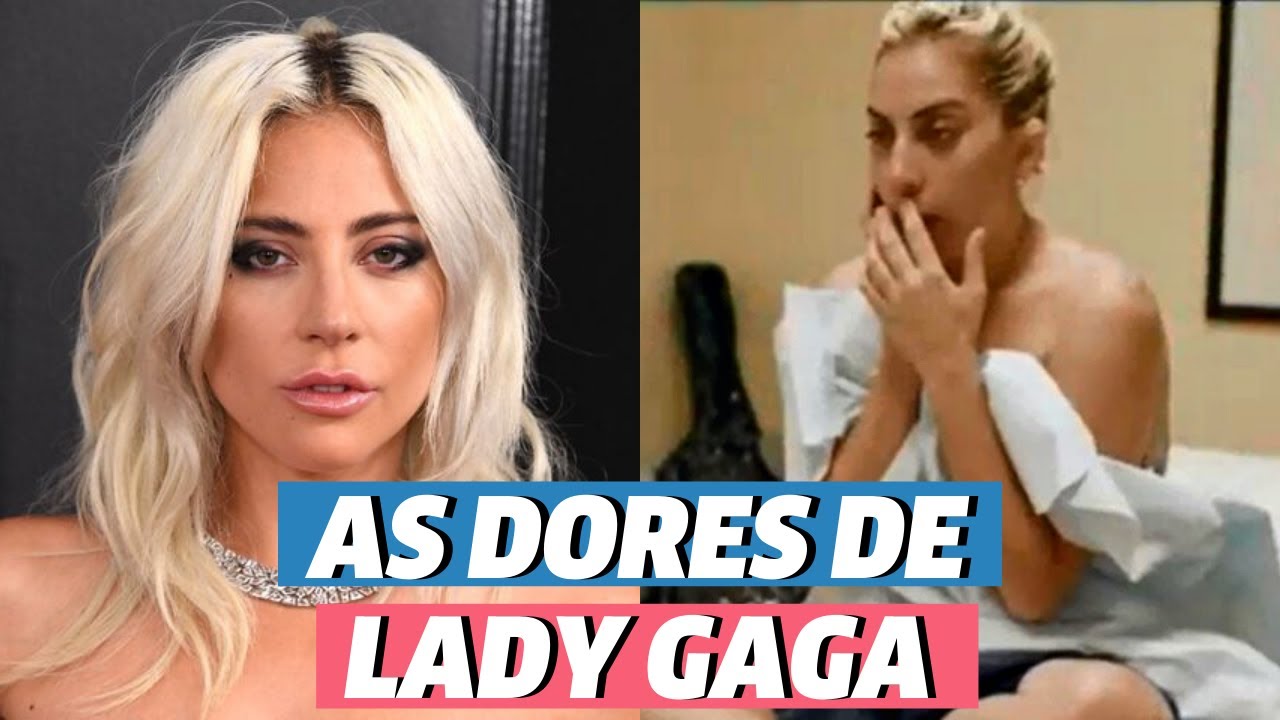 Lady Gaga sofre de fibromialgia: você sabe o que é? | Famosos | VIX Icons