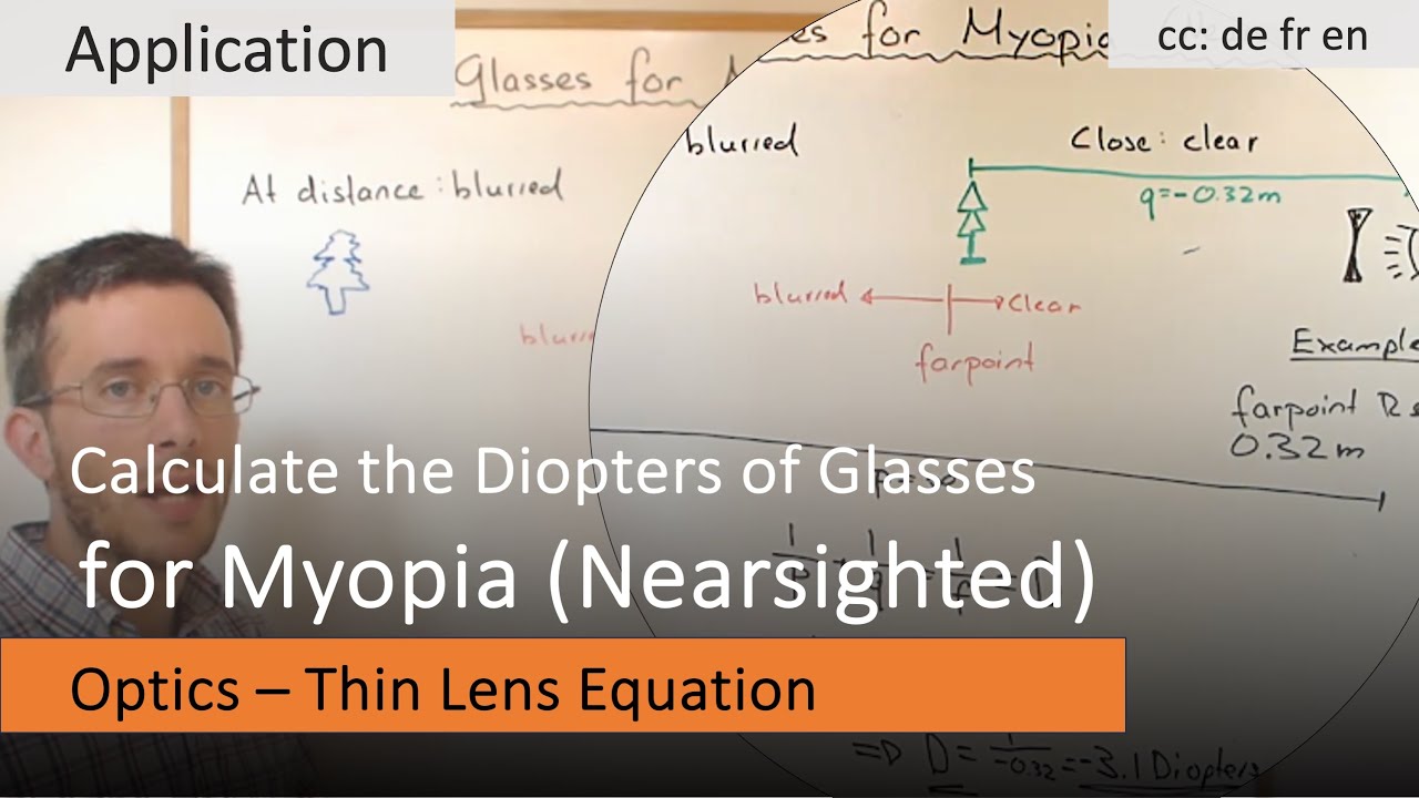 Calculating the diopters of glasses for Myopia