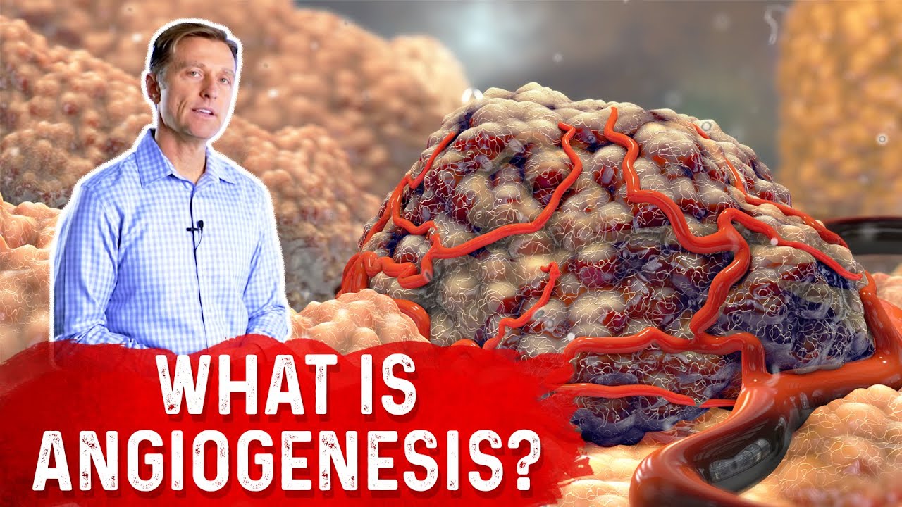 What is Angiogenesis? &ndash; Dr. Berg