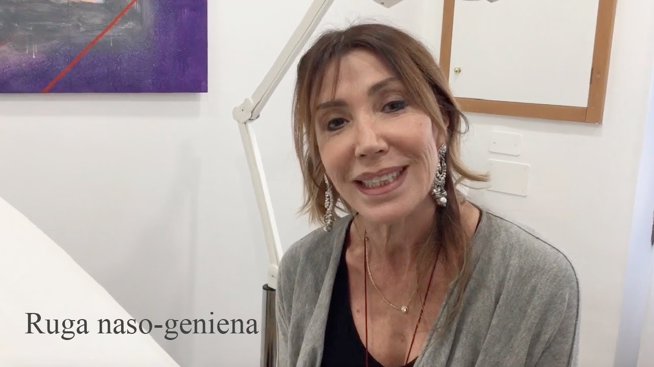 Ruga naso-geniene - Medicina estetica come correggere l'imperfezione