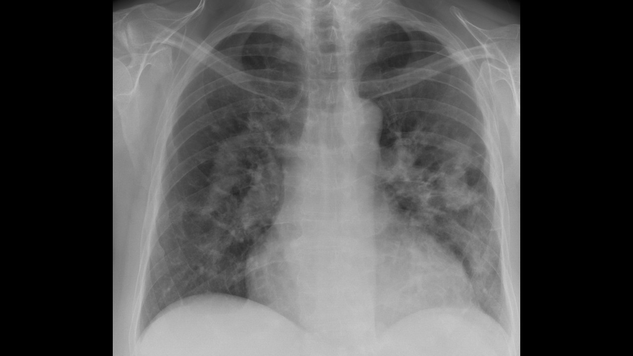 Cardiothoracic case webinar 2/19/2026