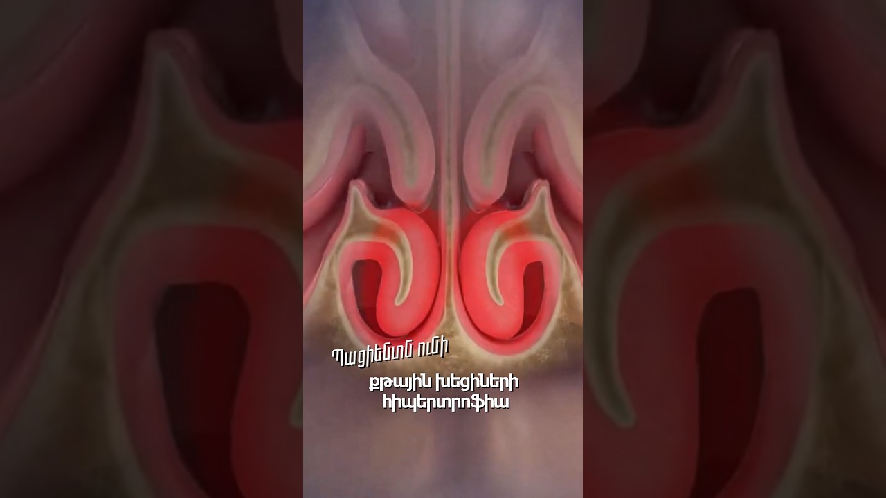 👨‍⚕️Դիմածնոտային վիրաբույժ Կարեն Վարդանյան