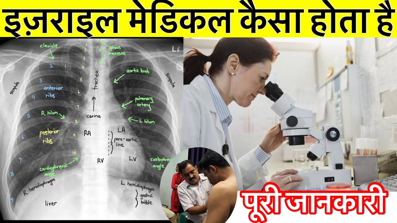 Israel 🇮🇱 Medical 🏥 इज़राइल मेडिकल फिट कैसे निकले।मेडिकल का खर्चा कितना होता है।ENU HELP