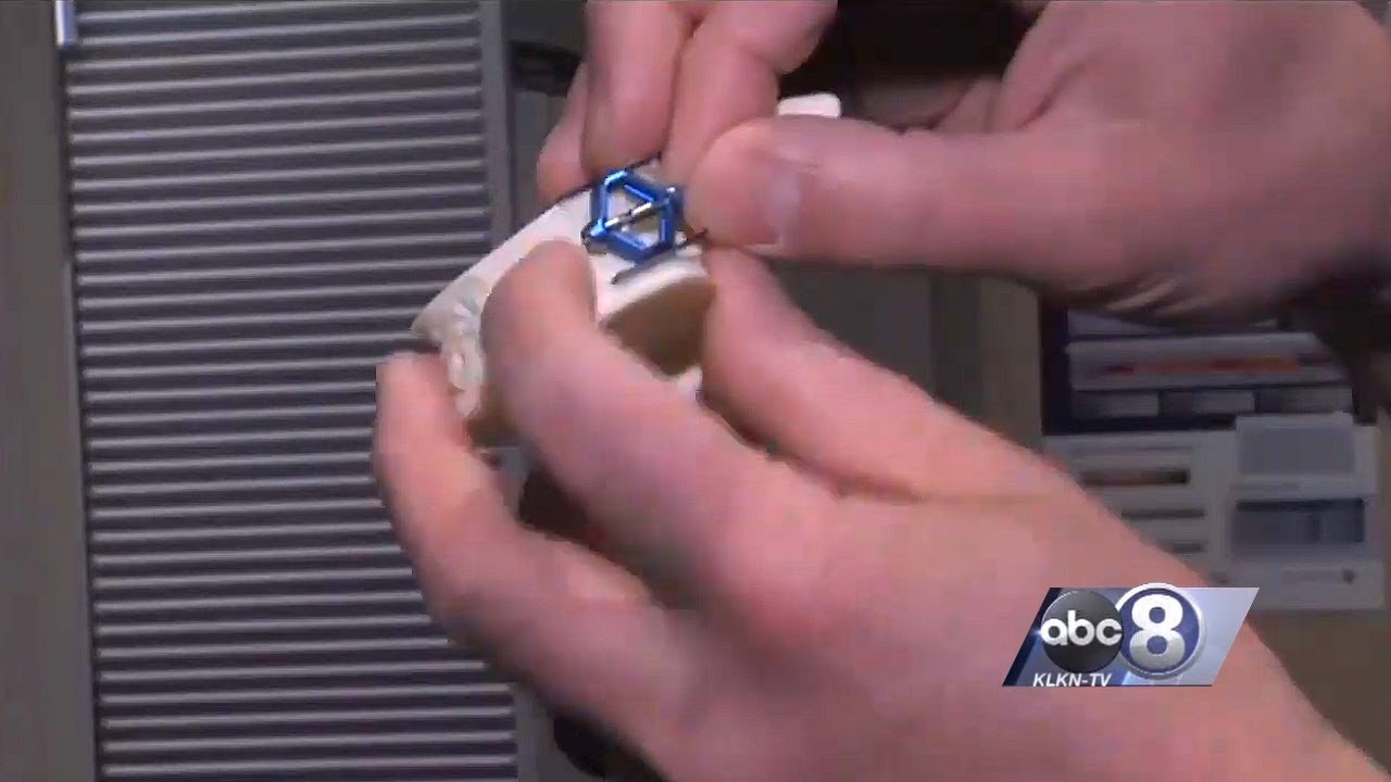 KLKN-TV: SpineJack Treatment at Bryan Medical Center Eliminates Severe Back Pain