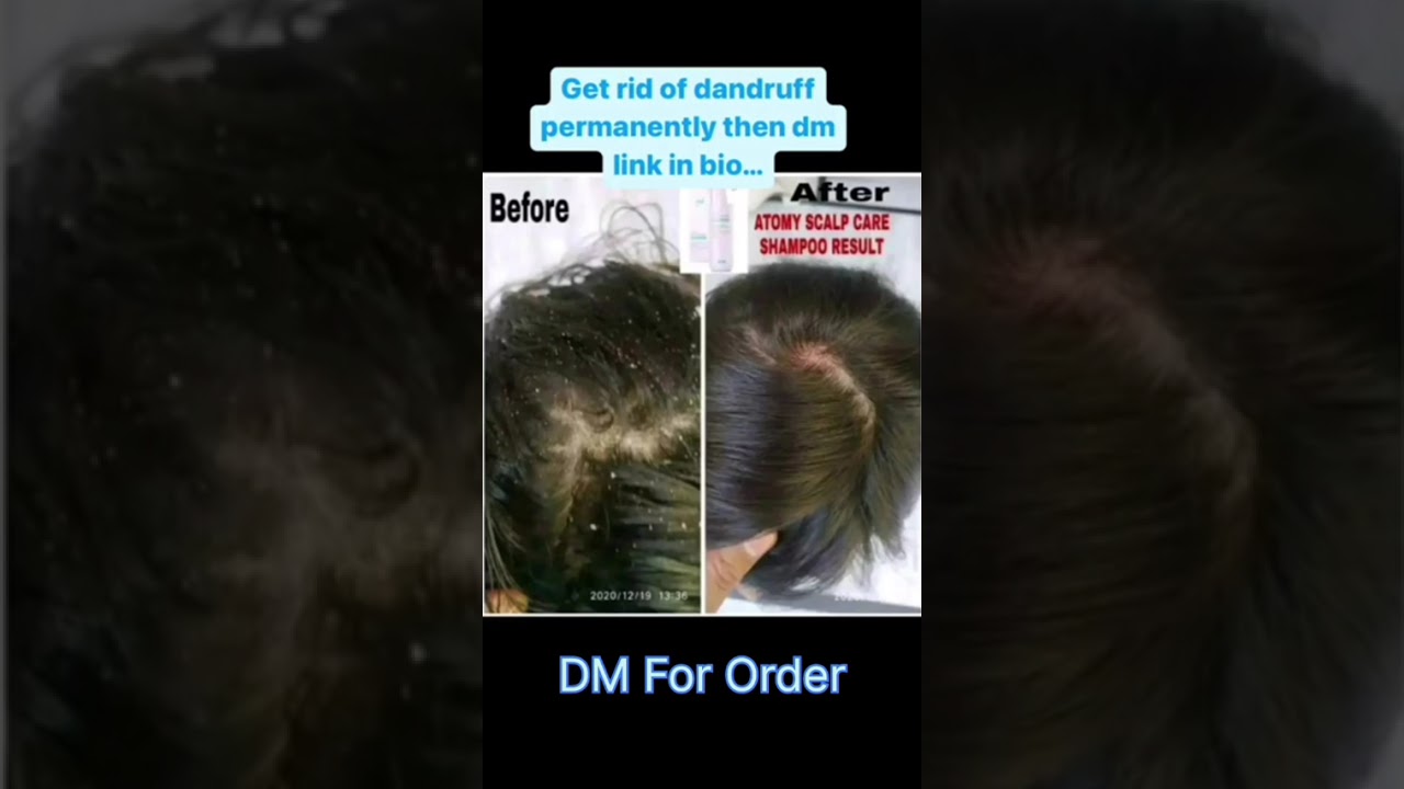 Atomy # Herbal Hair Care # scalp Care # Shampoo