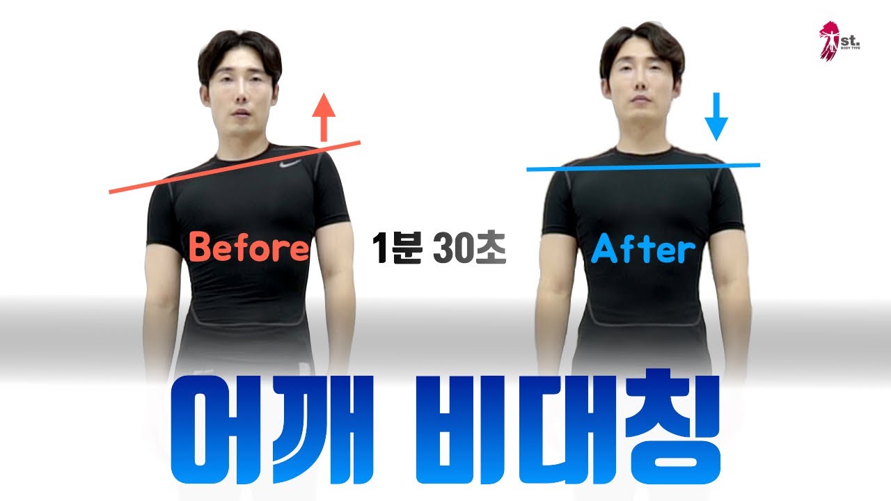 어깨 비대칭 교정 시리즈 1 : 올라간 어깨 1분 30초 만에 교정 하기 (불균형 원리와 방법) [바디퍼스트 실전체형해부학 29]