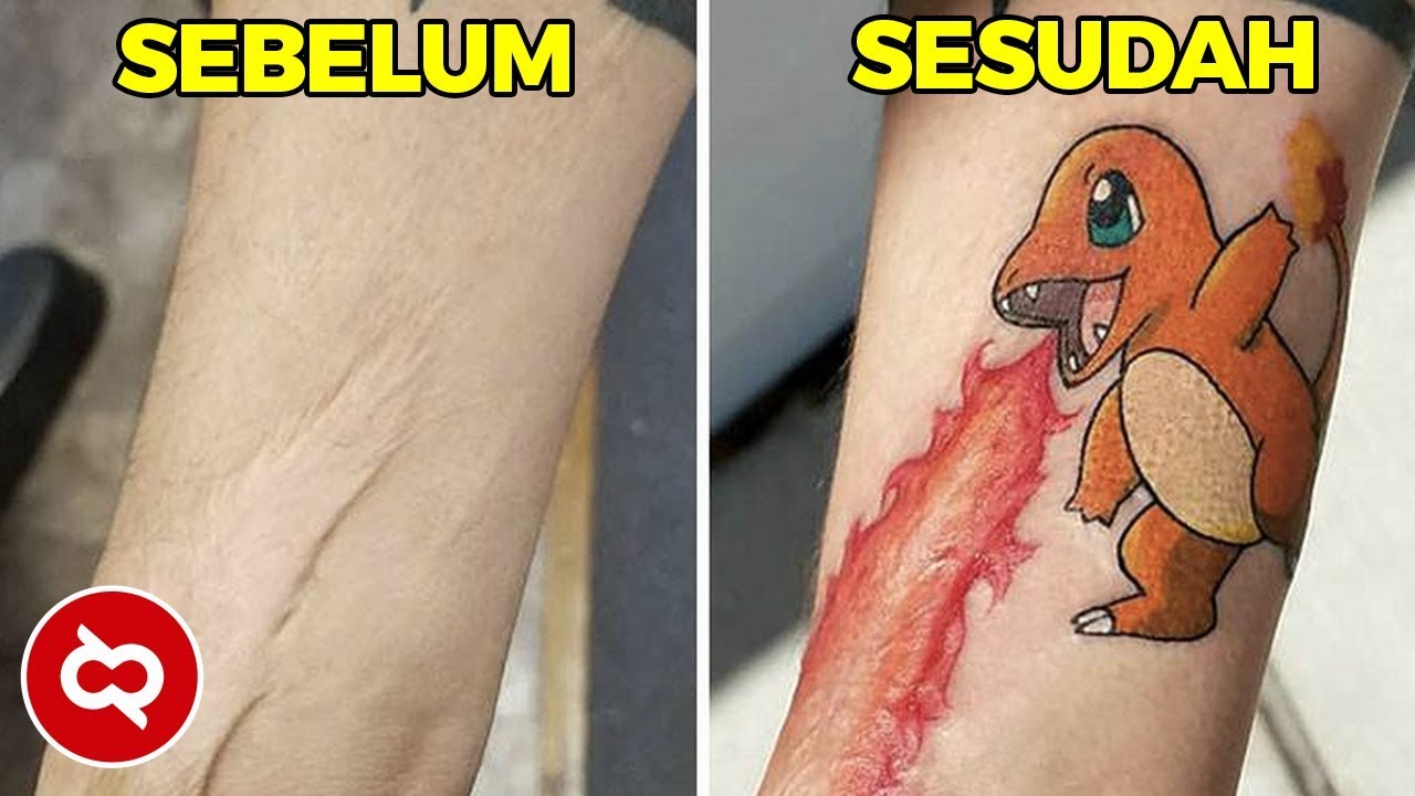 KELEWAT KREATIF! Bekas Luka Diubah Menjadi Hasil Karya yang Mengagumkan