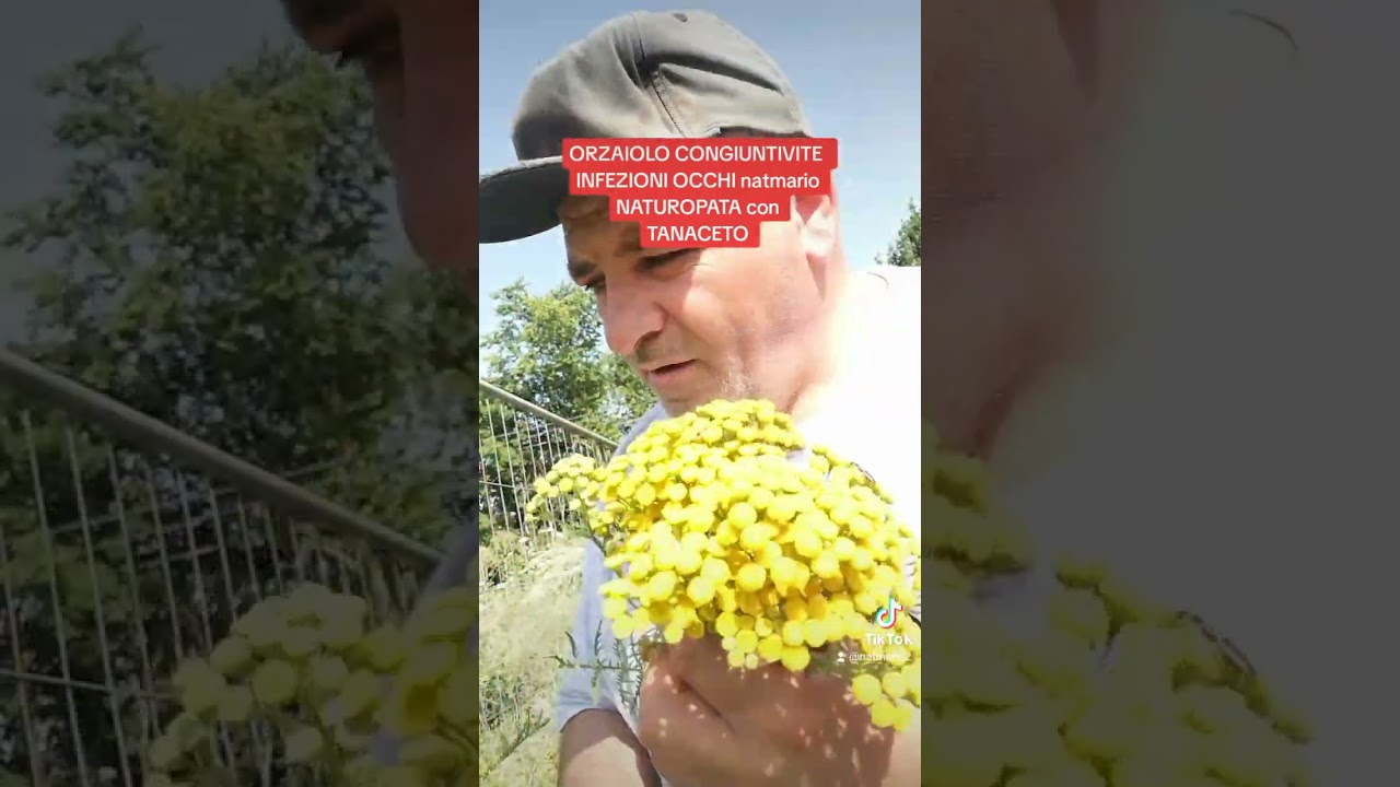 ORZAIOLO CONGIUNTIVITE  INFEZIONI OCCHI natmario NATUROPATA con TANACETO rimedi naturali