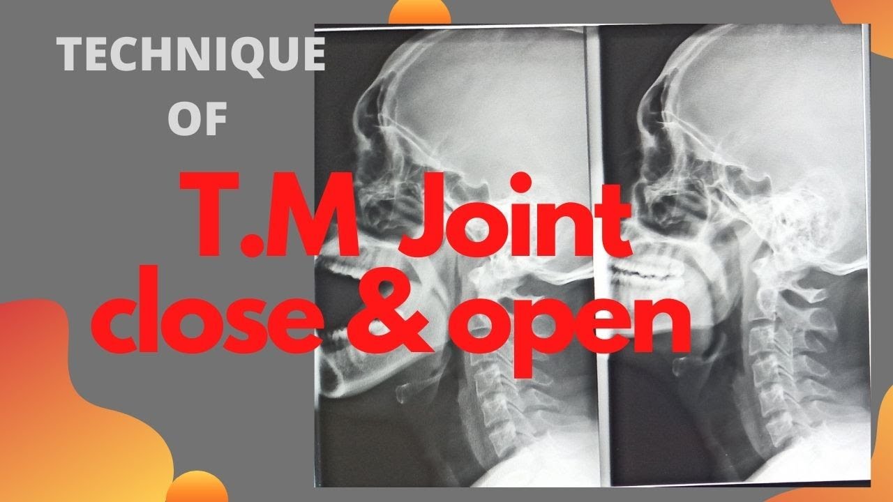Technique of T.M  joints close & open mouth (Ep-46)|Temporomandibular joint| close & open mouth TMJ