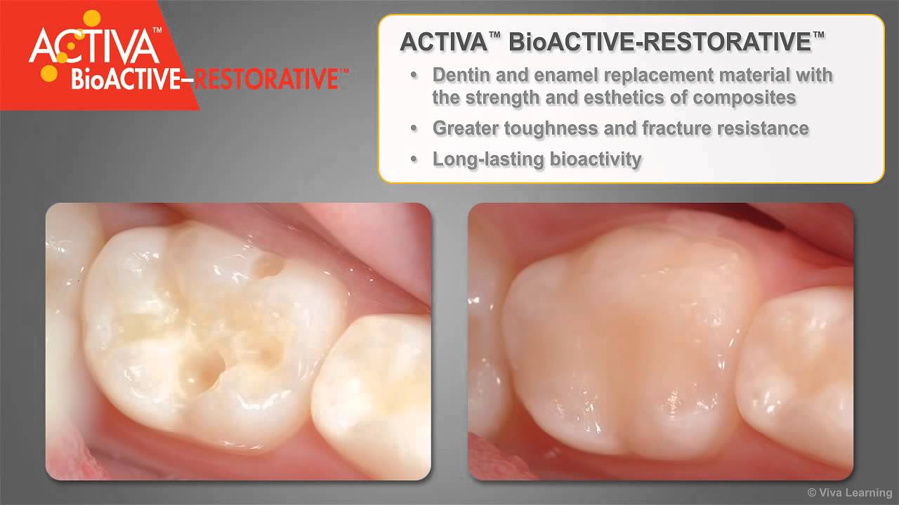 ACTIVA BioACTIVE D 720p