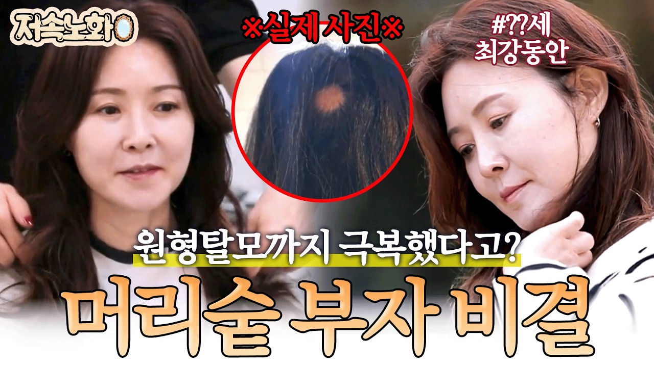 [#저속노화] ※나이 추측 불가※ 원형탈모 극복하고 풍성한 머리숱으로 다시 태어난 동안미녀의 비결은?✨ | 순정시대