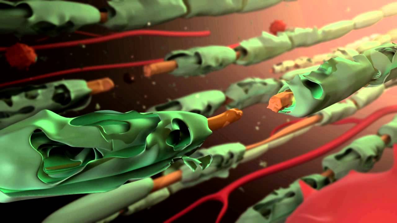 Macrophages in Neuropathic Pain