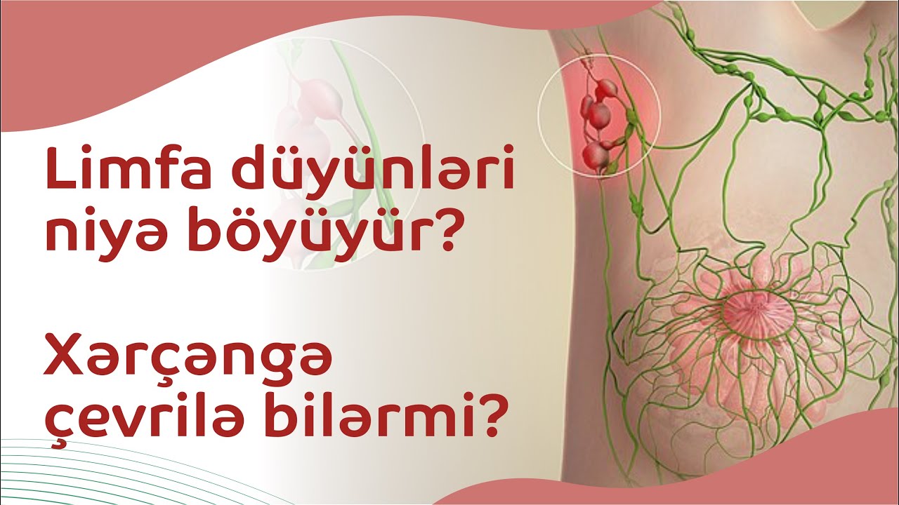Limfa düyünləri niyə böyüyür? Xərçəngə çevrilə bilərmi?