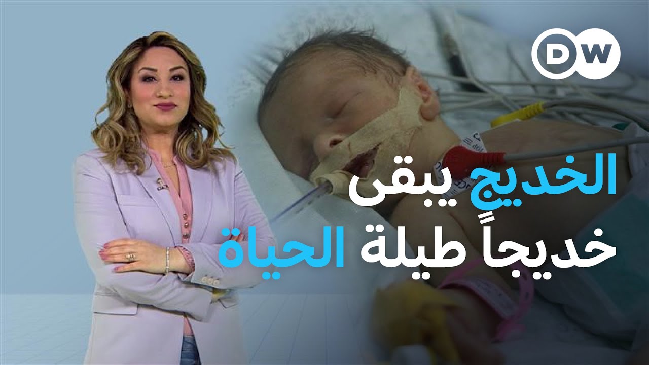تداعيات الولادة المبكرة ترافق الطفل الخديج عند الكبر ومدى الحياة | عينٌ على أوروبا