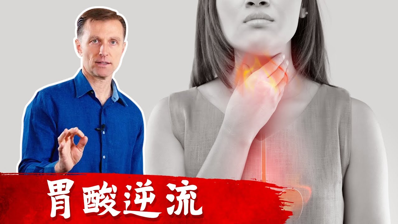胃潰瘍、腸胃炎、胃酸逆流7個自然療法.柏格醫生 Dr Berg