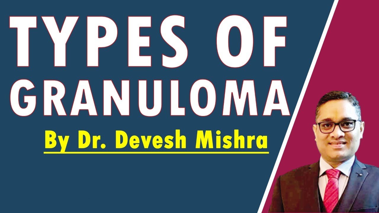 Types of Granuloma by Dr. Devesh Mishra