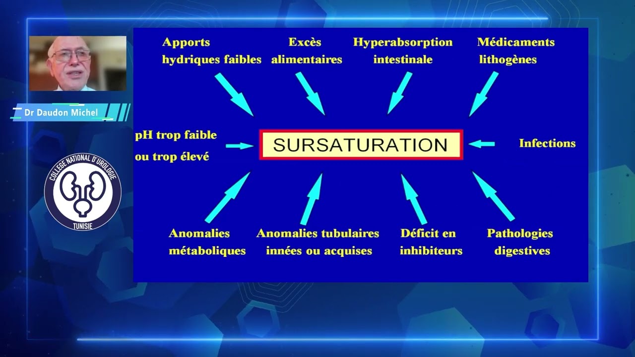 Epidémiologie et physiopathologie des lithiases urinaire