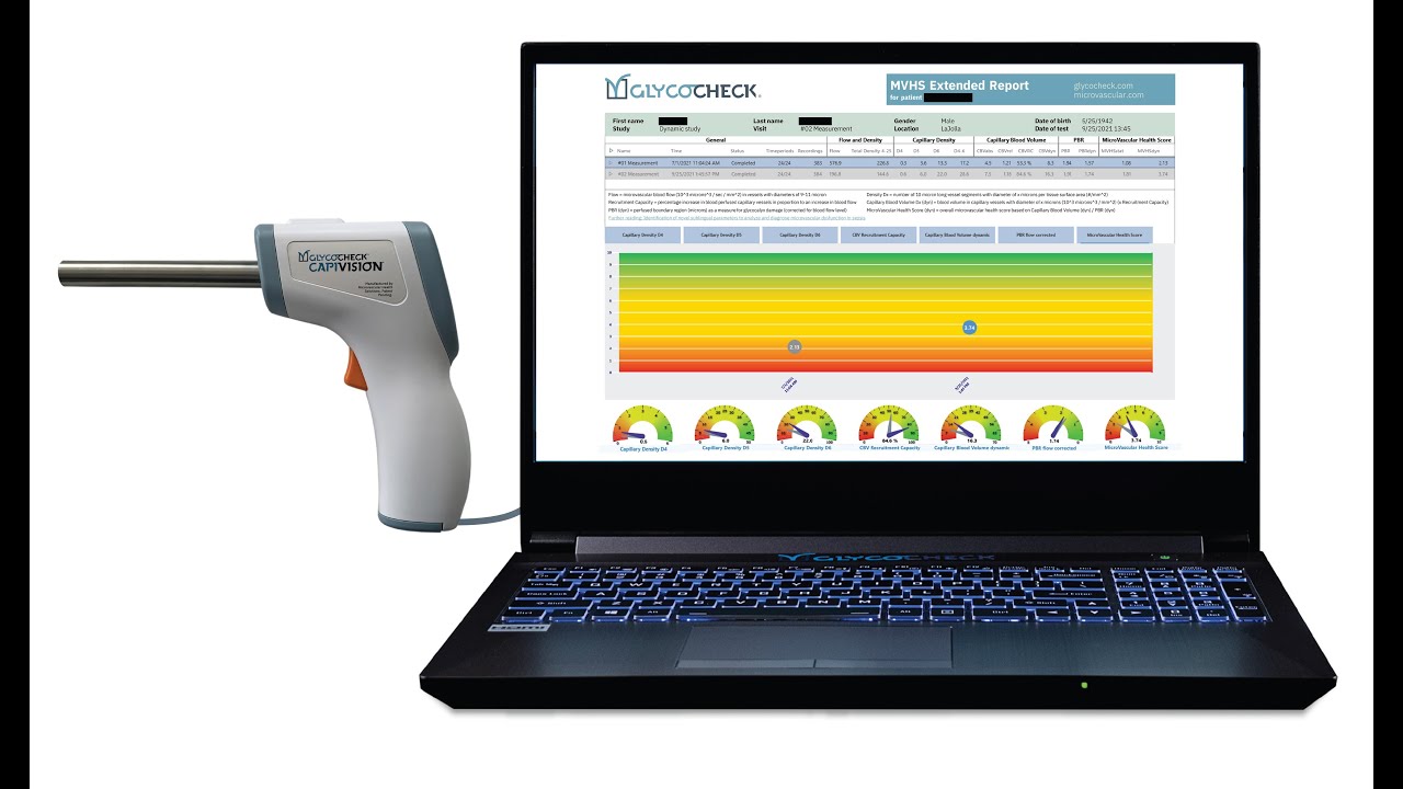 Testing and Detection of Glycocalyx Damage with GlycoCheck
