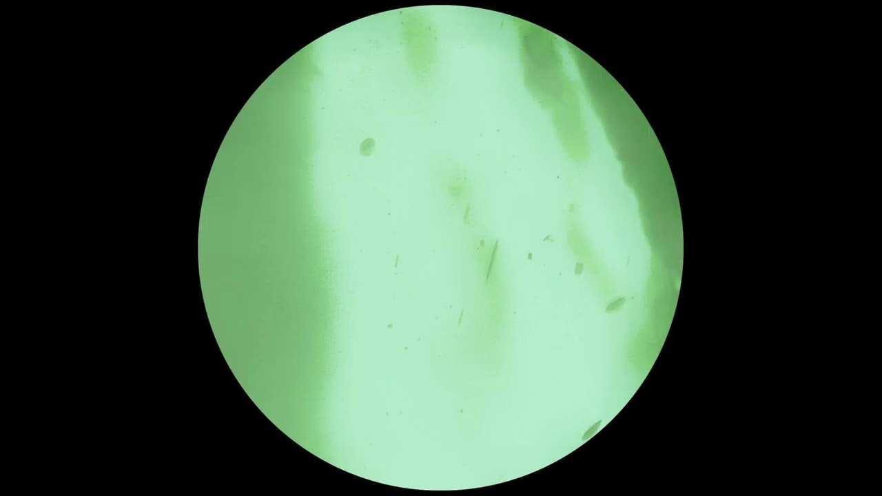 Overt - Follow