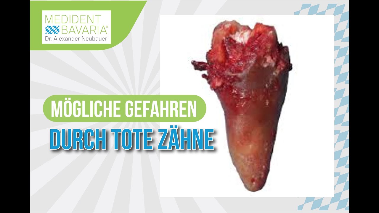 Mögliche Gefahren durch tote Zähne