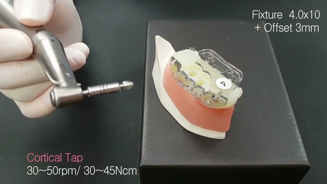 5. VARO Guide Surgery (Eng Sub)