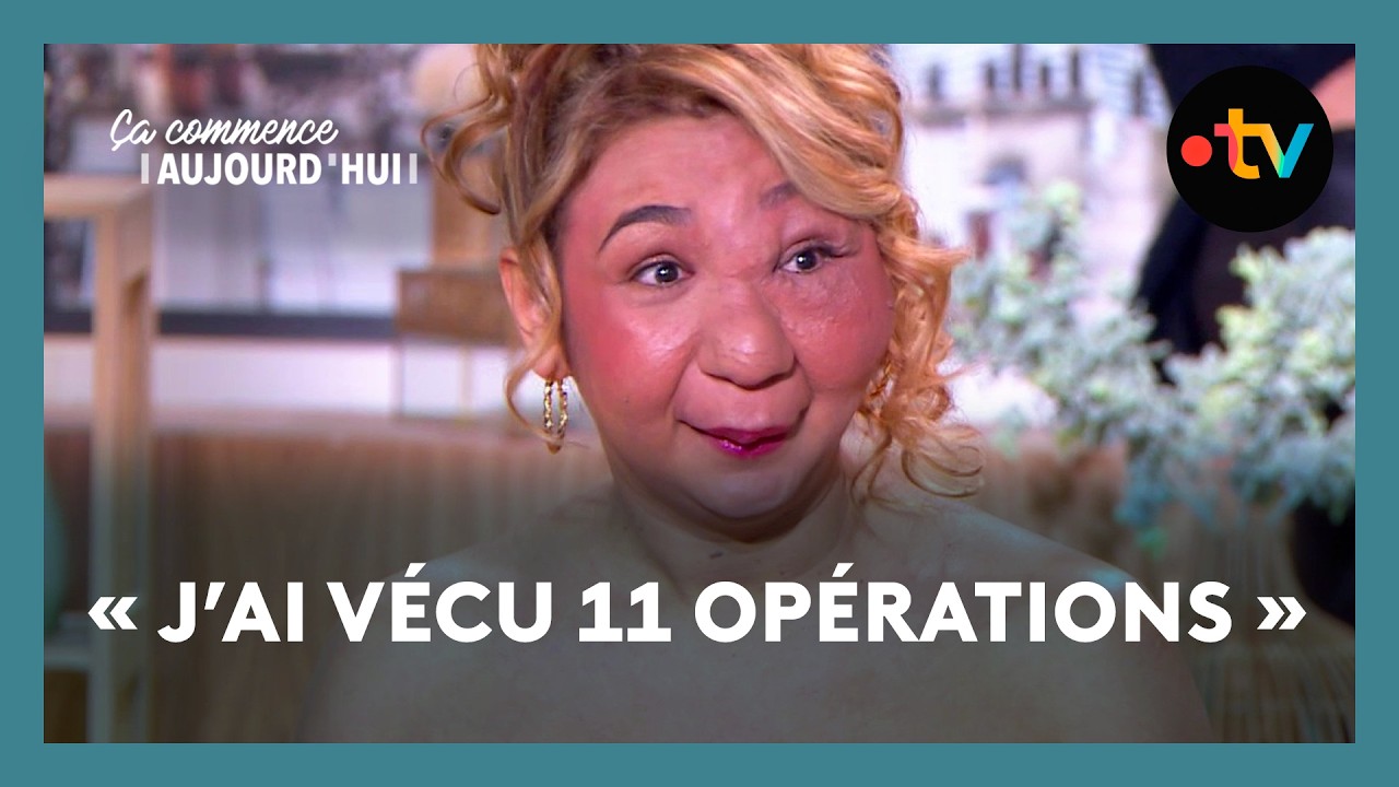 Malformation artério-veineuse : 