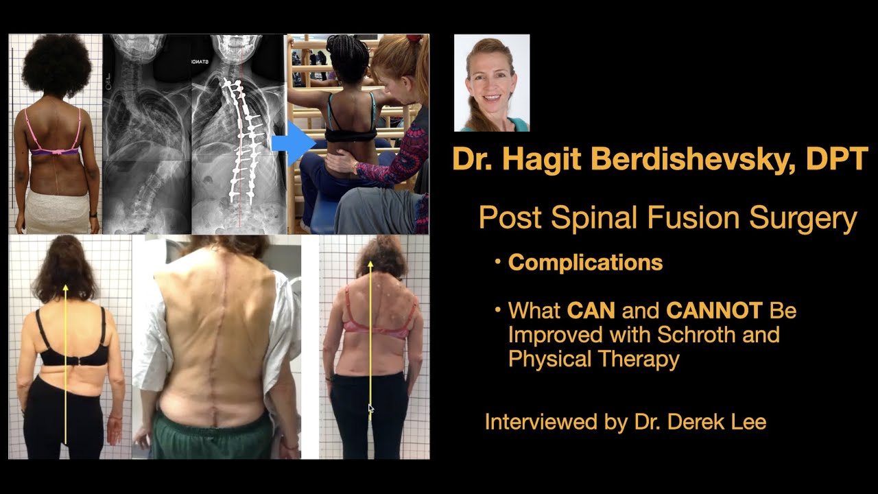 Dr. Hagit Berdishevsky, Spinal Fusion Complications & What Can/Cannot Improve with Schroth/Physio.