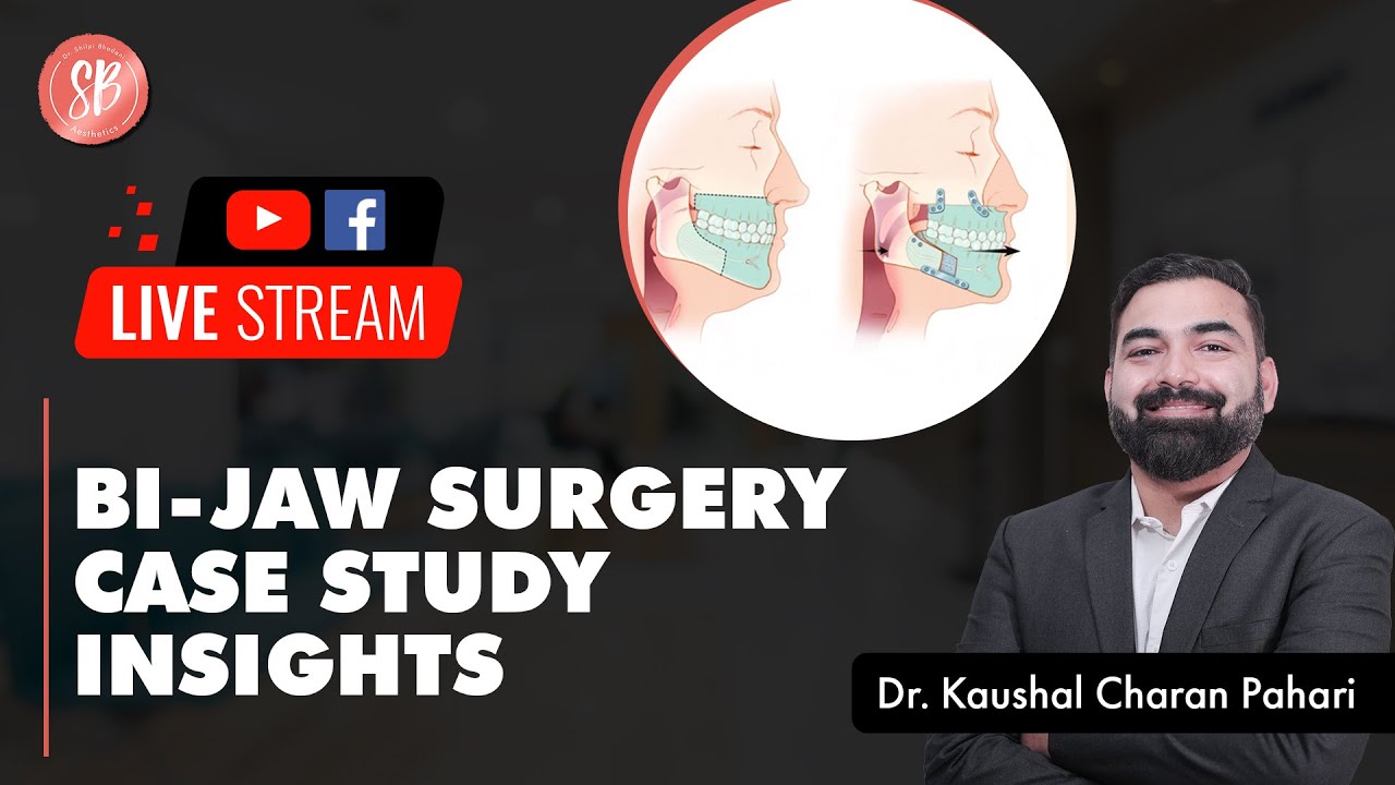 Bi-Jaw Surgery | Double Jaw Surgery | Double Jaw Surgery for Long Face | Jaw Surgery | SB Aesthetics